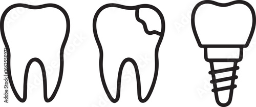 line drawing of healthy tooth, decayed tooth, and dental implant vector illustration
