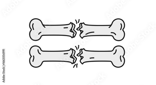 Visual representation of bone fractures and healing process in medical illustrations