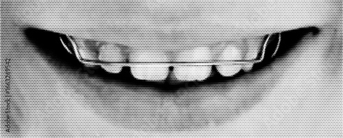 Collage halftone teeth smile. Abstract dotted pattern of mouth with teeth in retro pop art comic style. Halftone braces teeth closeup. Dental orthodontics abstract dot pattern mouth vector background