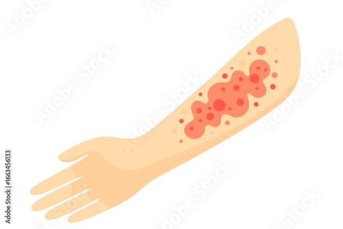 Inflamed skin on human arm with red spots on white background skin rash on arm