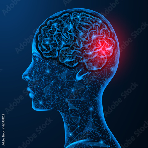 Hypertension of the brain. Headache or vascular damage to the occipital region of the head. Low-poly design, blue background.