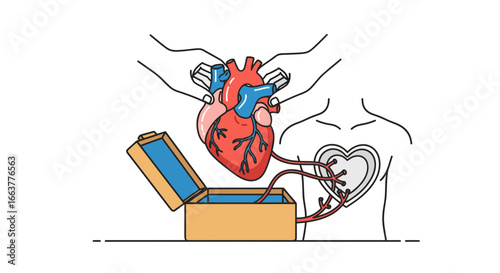 Heart transplant illustration showing a human heart being placed into a chest cavity from a cooler box for medical procedure