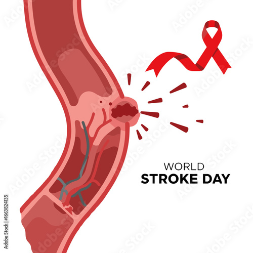Illustration of blood vessel with stroke symbol for World Stroke Day  