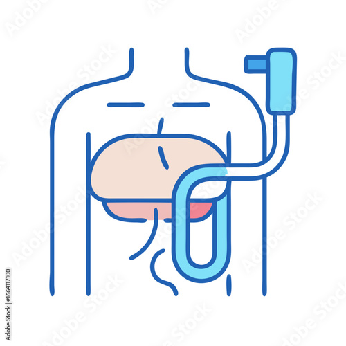 Bariatric surgery illustration for weight loss with modern design