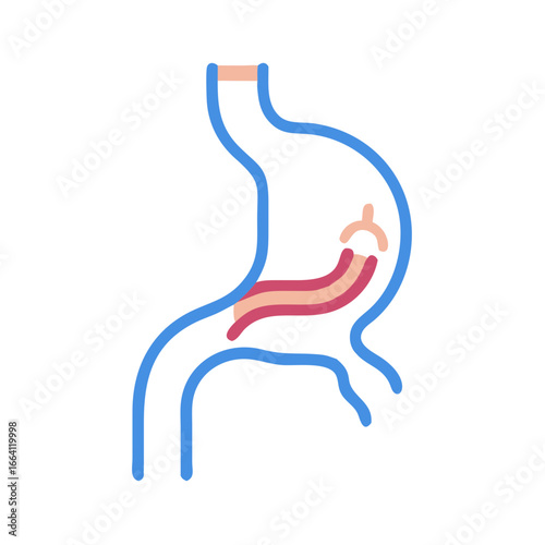 Anatomical illustration showing stomach and internal lining layers
