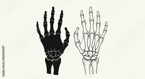Two skeletal hands, one solid black, one outlined, displayed side-by-side on a light background.