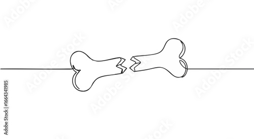 A delicate line drawing that shows a broken bone.