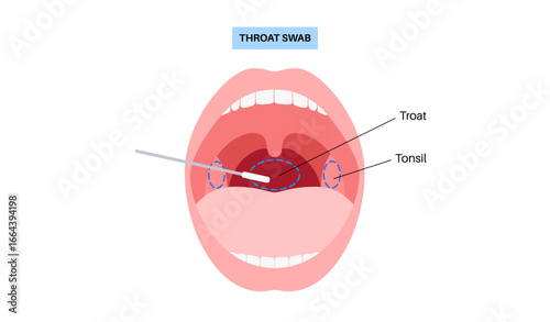Swab throat procedure