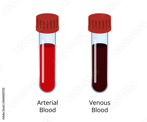 Comparing arterial and venous blood samples in test tubes