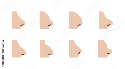 Various Nose Shapes Representing Rhinoplasty Options for Diverse Patients