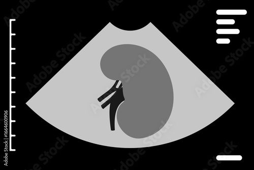 Ultrasound Scan Displaying Human Kidney Anatomy