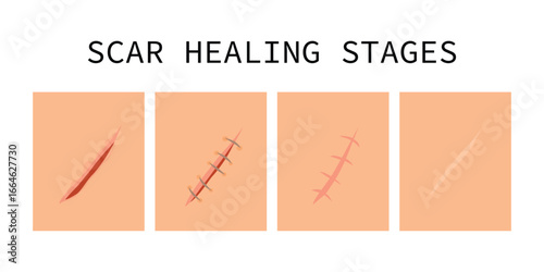 Set of healing wounds, skin scars, stitched gash and cuts