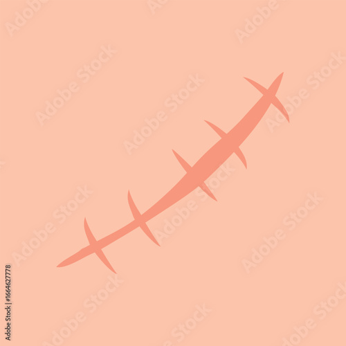 Scar or stitch on human skin, healed wound