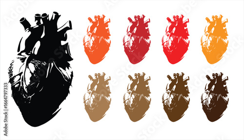 Heart Attack ECG Vector – Cardiology, Paramedic, Cardiac Health Illustration	