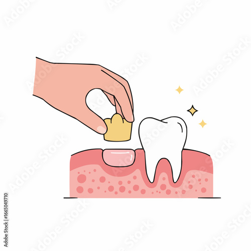 Hand placing dental crown on tooth model with gum illustration, isolated on white background     