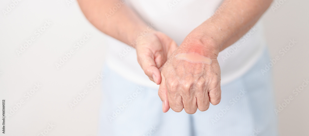 Fototapeta premium Elderly Woman having wrist pain with Medicated pain relief patch plaster for Carpal Tunnel Syndrome, Wrist Tendinitis, muscle ache, De Quervain s tenosynovitis, Hand Osteoarthritis and Senior health