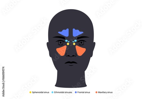 Paranasal sinus poster