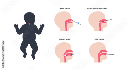 swab medical procedure