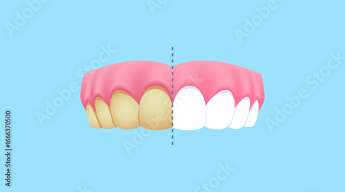 Upper teeth - Brown (Before and After Comparison) illustration vector design. Dental care concept.
