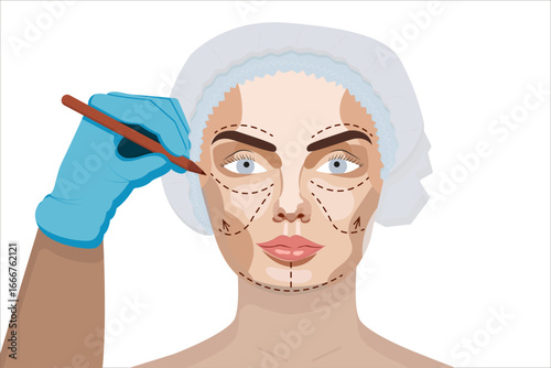 An illustration of a cosmetic surgery procedure showing a gloved hand marking a woman's face with a marker, wearing a surgical cap, on a white background.