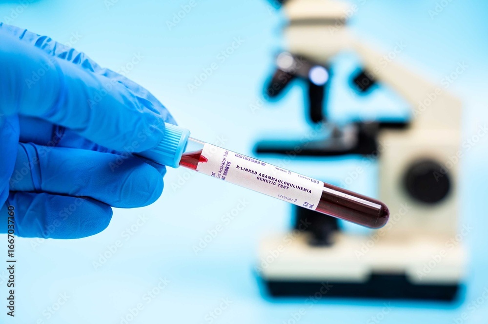 Naklejka premium Identifies mutations in the BTK gene, causing X-linked