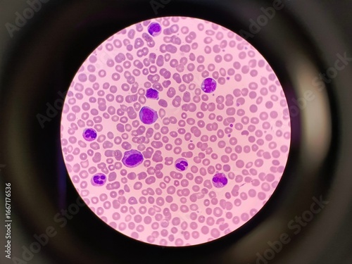 Human blood under a microscope in laboratory. 