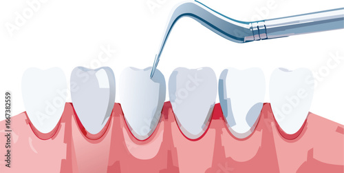 Oral care procedure encouraging emotional intelligence and health awareness
Dental tool on gums promoting understanding of science in everyday life