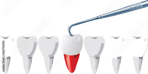 Oral health awareness illustration with dental tool inspecting damaged tooth
Vector image showing dental examination and cavity detection for health education