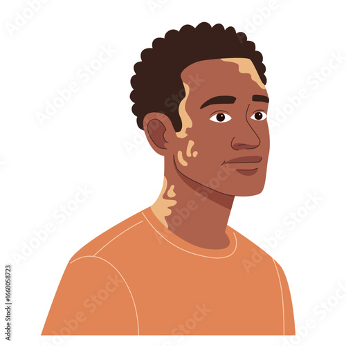 Young african american man with vitiligo. Diverse skin condition or pigmentation disorder. Self acceptance and skin health concept.