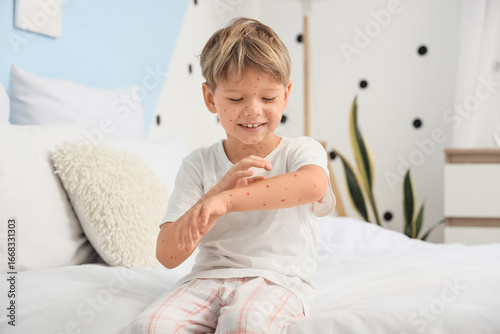 Little boy ill with chicken...