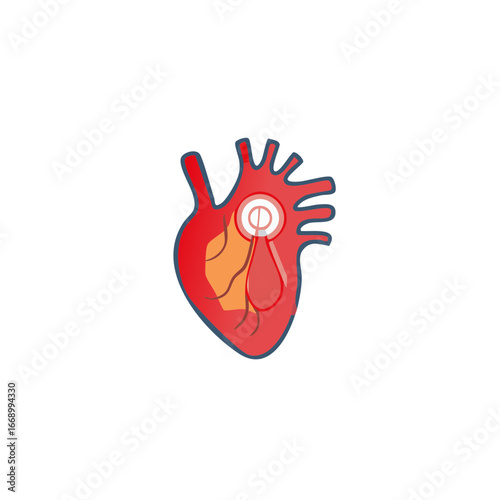 Human heart anatomy with coronary vessels shown for medical education.
