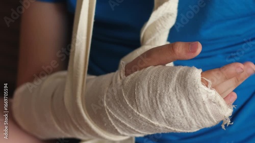 close-up of a child's hand in a plaster cast checking finger mobility after a bone fracture, a child at a traumatologist's appointment after a broken arm