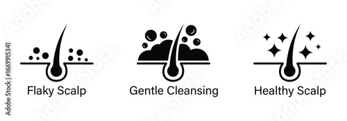 Anti dandruff icon set. Strong healthy hair line icons. Anti dandruff logo, label, badge, symbol, black, circle, line, vector, isolated illustration. Anti dandruff label for product packaging design.