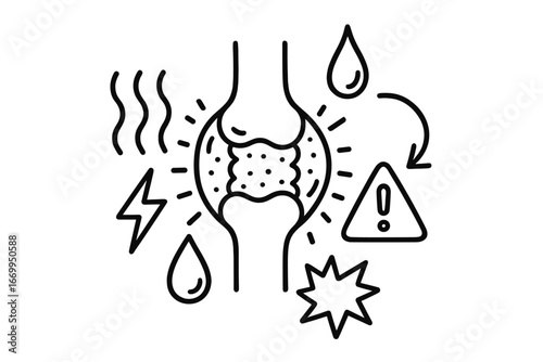 Joint Inflammation Doodle. Hand-drawn doodle illustration inflammation and synovial fluid swollen joint icon, irritated synovial