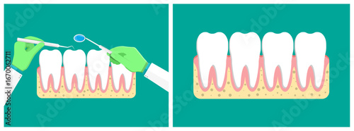 Dentist s hands in green gloves examining human teeth. Professional stomatologist cleaning and checking healthy teeth in the mouth concept.