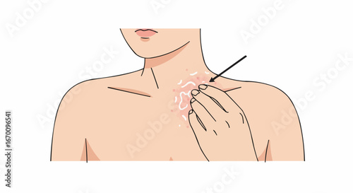 Person treating skin irritation on neck with cotton swab  