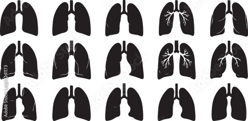 Medical visualization of human lungs showing different conditions and anatomical variations