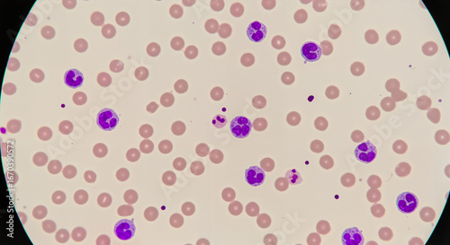 Microscopic view of blood cells with purple-stained leukocytes  