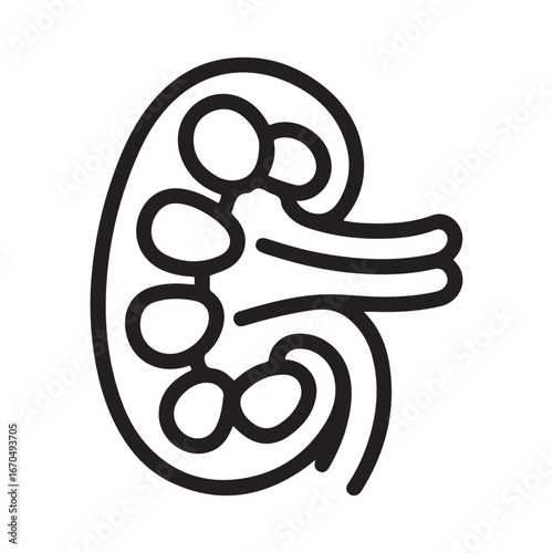 Kidney stones line icon, Human diseases concept, dialysis, Treatment of kidney stones icon. Vector black silhouette. with white background