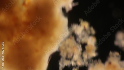 Vorticella (organism) in waste water under the microscope.