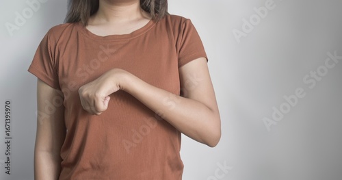 Volkmann contracture affecting the left upper limb of a young Asian woman