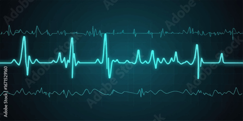 An electrocardiogram displays the rhythmic heartbeat pulse as a green wave on a medical monitor