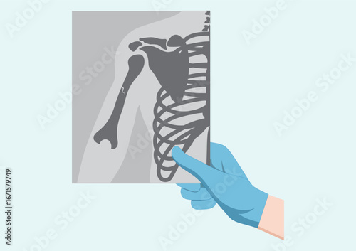 Medical doctor looking at x-ray picture of arm in hospital.