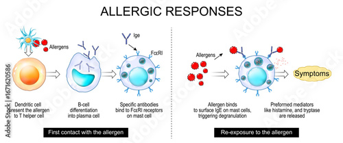 Allergy mechanism and Allergic responses