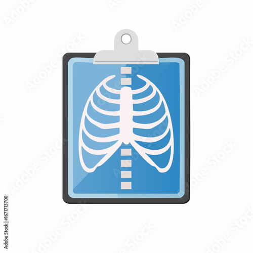 Chest X-ray vector graphic with rib cage and spine illustration