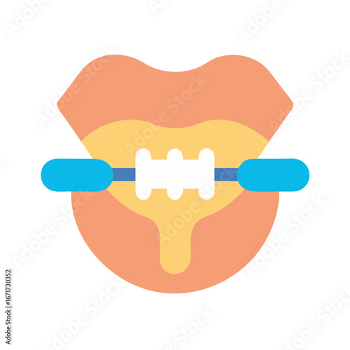 Flat design illustration of teeth with braces concept art