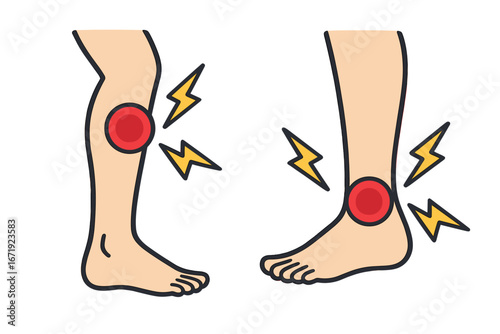 Injury symbols depicting leg pain with red target marks and lightning bolts illustrating discomfort in calves and ankles, cartoon vector medical illustration on transparent background