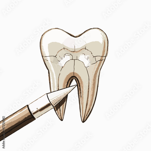 Dental Examination Of A Cracked Tooth With A Dental Probe On A White Background broken
