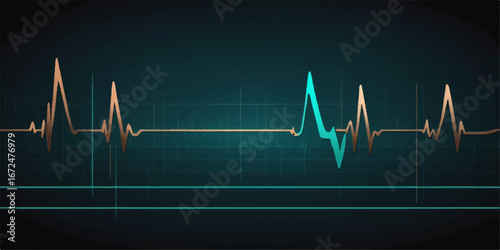 A medical cardiogram showing the green heart rate pulse trace on an ECG monitor