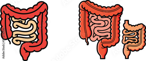 Human Intestines: Large and Small Intestine Diagram